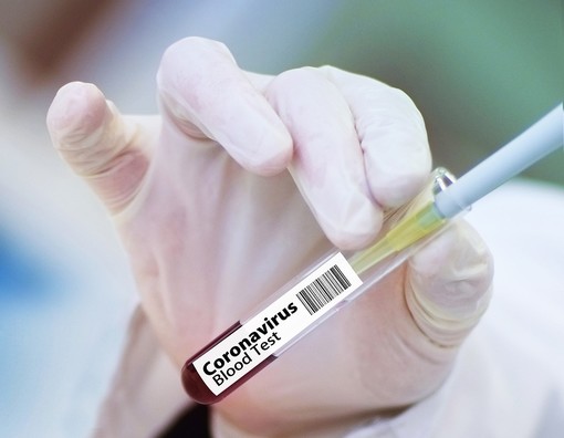Pfizer annuncia: «Il nostro vaccino contro il Coronavirus efficace al 90%. Prime dosi entro l'anno»