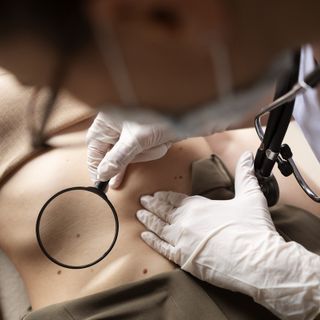 Cuneo: l'Ospedale S. Croce apre le porte agli specialisti di Dermochirurgia