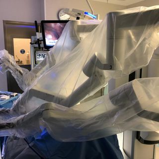 Ha una massa tumorale di dieci centimetri sopra il cuore: alle Molinette lo salvano con un intervento mininvasivo robotico