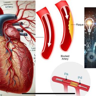 Quando fare l’angioplastica coronarica? Ora lo dice l’Intelligenza Artificiale