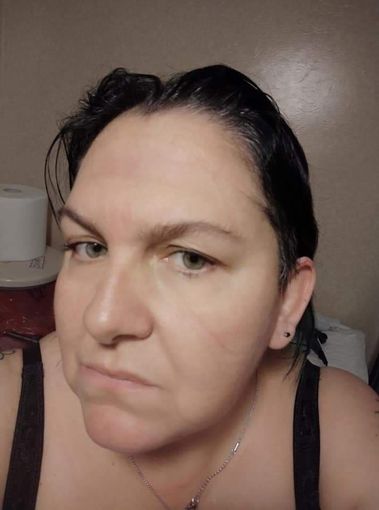 Giù la maschera: infermiera braidese mostra il volto dopo un turno in un reparto Covid Giù la maschera: infermiera braidese mostra il volto dopo un turno in un reparto Covid