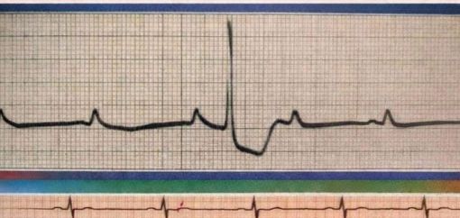 Alba: elettrocardiogrammi gratuiti per tutti grazie alla Croce Rossa Alba: elettrocardiogrammi gratuiti per tutti grazie alla Croce Rossa