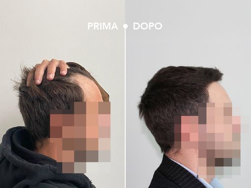 CRLAB: scienza, cura e personalizzazione per ritrovare sé stessi, partendo dai capelli