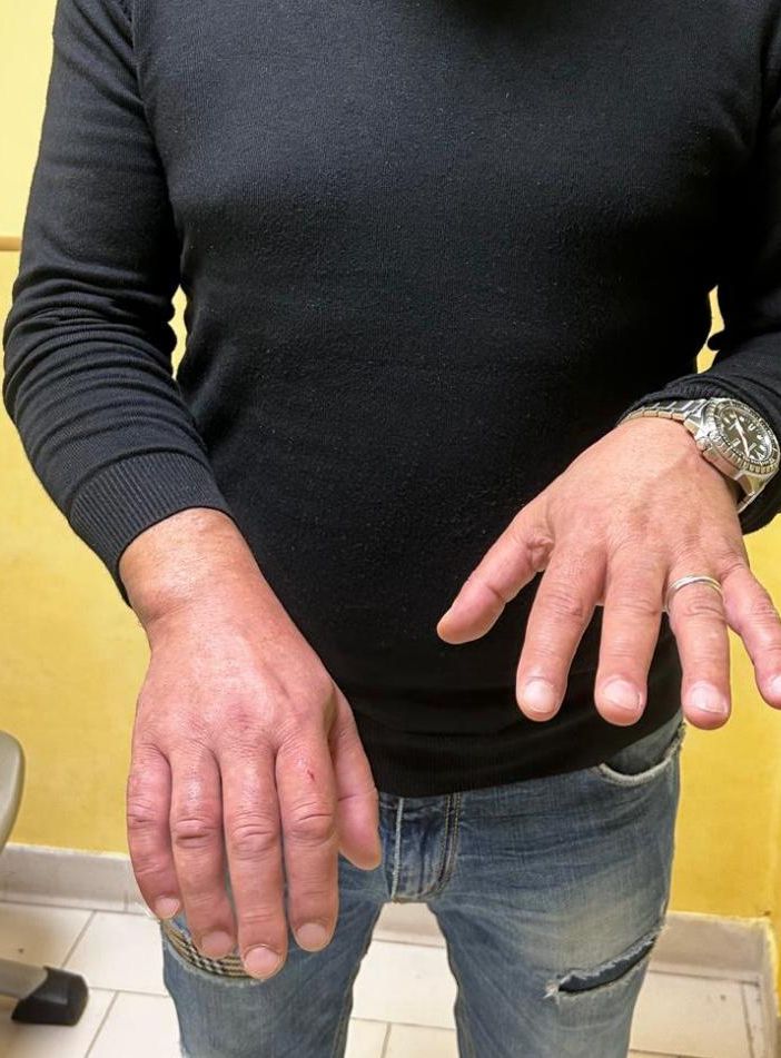 Carcere di Cuneo, detenuto in isolamento appicca fuoco in cella e distrugge i sanitari ferendo l'agente penitenziario con i cocci