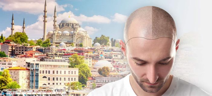 Perché fare un trapianto di capelli in Turchia? Perché fare un trapianto di capelli in Turchia?