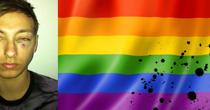 Ragazzo gay ferito e colpito da spray urticante sul treno a Cuneo?