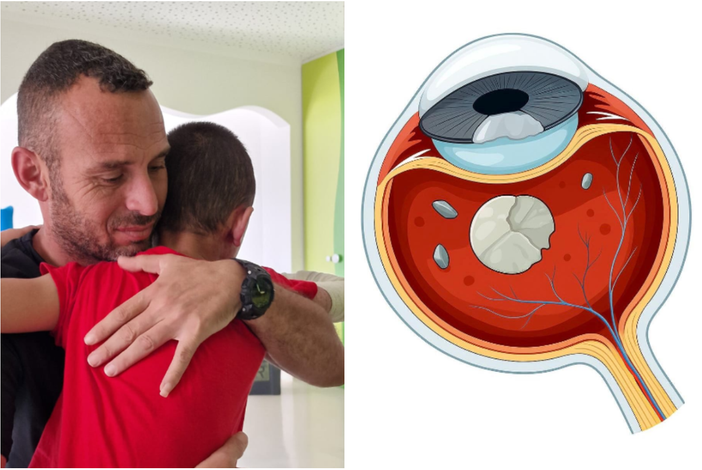 Perde la vista per l’esplosione di una bomba a Gaza: Assad, 8 anni, torna a vedere dopo l’intervento a Torino