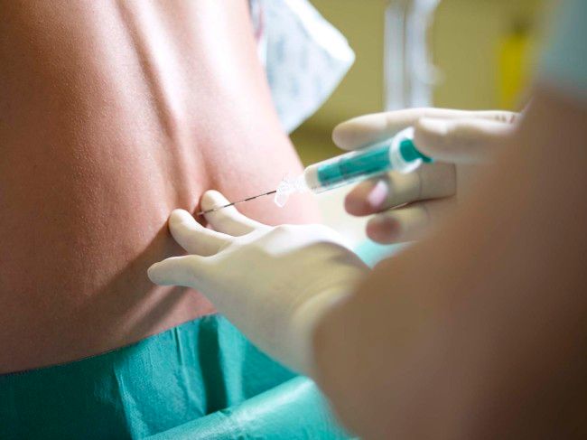 Ancora sull’epidurale: “Forse mi sono permessa di dire a voce alta quello che tante donne pensano”