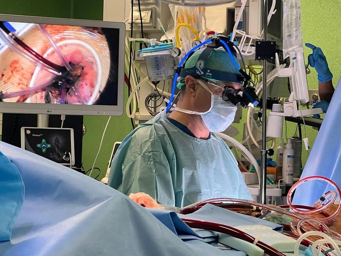 Alla Cardiochirurgia del S. Croce e Carle di Cuneo un caschetto con telecamera per gli interventi mini invasivi Alla Cardiochirurgia del S. Croce e Carle di Cuneo un caschetto con telecamera per gli interventi mini invasivi