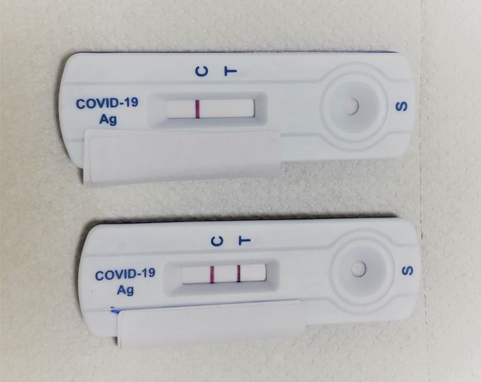 Test antigenici rapidi per Sars Cov-2 al Laboratorio Pasteur di Cuneo