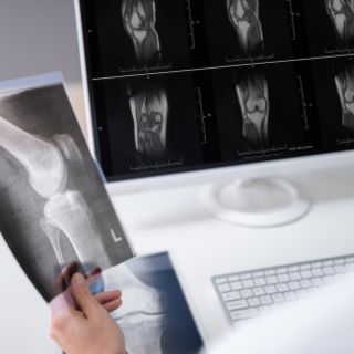 Referti radiologici online da oggi per gli utenti dell'Asl Cn2: immagini e documenti scaricabili da remoto