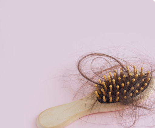 Caduta stagionale o qualcosa di più? Capire i segnali che arrivano dai capelli Caduta stagionale o qualcosa di più? Capire i segnali che arrivano dai capelli
