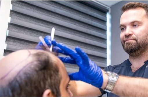 5 segnali precoci di caduta dei capelli che vengono scambiati per normale invecchiamento 5 segnali precoci di caduta dei capelli che vengono scambiati per normale invecchiamento