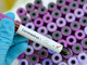 Coronavirus Piemonte: quattro nuovi guariti in Granda, non salgono i decessi