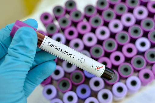 I sindaci di Alba e Bra: &quot;Anche i nostri ospedali aderiscono ai protocolli attivi in Piemonte su Coronavirus&quot;