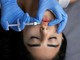 Photoaging e perdita di volumi post-estate: le strategie di medicina estetica per ripristinare il turgore del viso Photoaging e perdita di volumi post-estate: le strategie di medicina estetica per ripristinare il turgore del viso