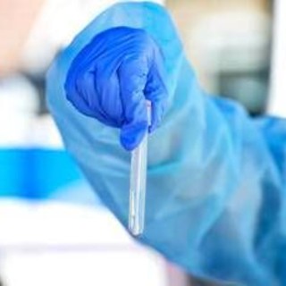 Hantavirus, il punto: contagio e sintomi, cosa c'è da sapere e come proteggersi Hantavirus, il punto: contagio e sintomi, cosa c'è da sapere e come proteggersi