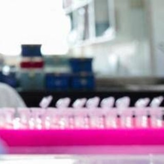 Staminali contro il Parkinson, in Giappone via libera al primo trattamento