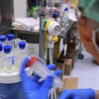 Legionella, a Milano sospetto focolaio: 11 casi con 1 morto in zona San Siro Legionella, a Milano sospetto focolaio: 11 casi con 1 morto in zona San Siro