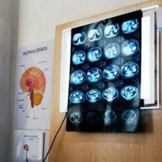 "11 anni di chemio per un tumore che non c'era", la diagnosi sbagliata e l'incubo