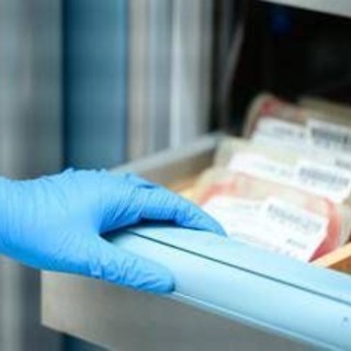 Leucemia mieloide cronica, esperto 'asciminib per bisogni clinici irrisolti' Leucemia mieloide cronica, esperto 'asciminib per bisogni clinici irrisolti'