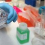 Cancro alla vescica, Berardi (Aiom): "Sangue nelle urine segnale da non sottovalutare" Cancro alla vescica, Berardi (Aiom): "Sangue nelle urine segnale da non sottovalutare"