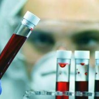 Leucemia linfatica cronica, con zanubrutinib sopravvivenza al 74% a 6 anni Leucemia linfatica cronica, con zanubrutinib sopravvivenza al 74% a 6 anni