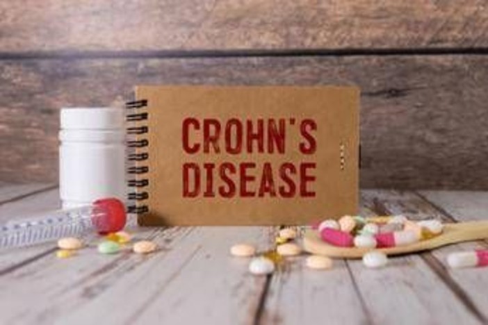 Malattia Crohn con fistole, nuovi dati su terapia monoclonale Malattia Crohn con fistole, nuovi dati su terapia monoclonale