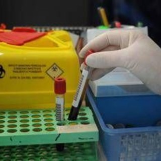 Tumori, nuovo test del sangue 'low cost' promette di scoprire diversi tipi di cancro Tumori, nuovo test del sangue 'low cost' promette di scoprire diversi tipi di cancro